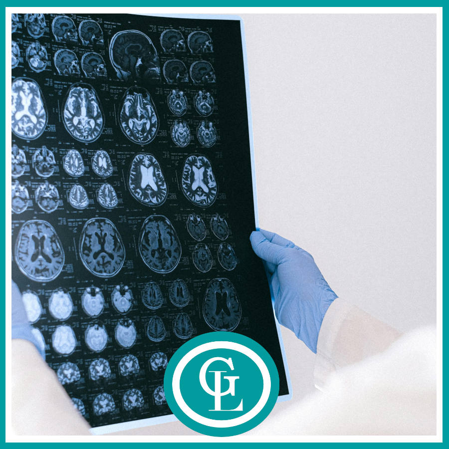 Día Mundial del Cerebro